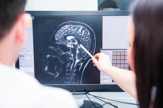 We are increasingly aware of the lifestyle factors that can help us take better care of our brain, but what could the future hold for treatment?