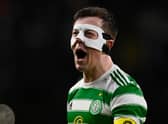 Celtic captain Callum McGregor wore a protective face mask during the 3-0 win over Rangers. (Photo by Rob Casey / SNS Group)