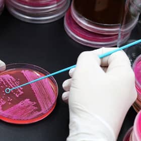 Antibiotic resistance is a real problem for science.