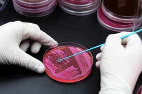 Antibiotic resistance is a real problem for science.