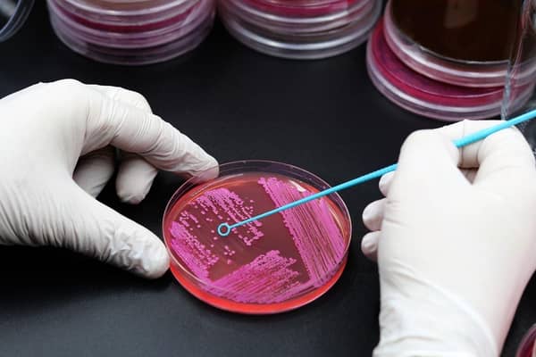 Antibiotic resistance is a real problem for science.