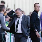 Celtic manager Ange Postecoglou looks vexed during the 4-2 defeat by Hibs.
