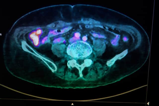 An image of the human body taken by a positron emission tomography scanner, also called a PET scan (Picture: Fred Tanneau/AFP via Getty Images)