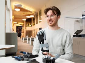 Among the Scottish winners is Fergal Mackie who has developed a body-powered bionic hand. Picture: contributed.