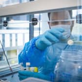 Scotland has recorded five deaths of coronavirus patients in the past 24 hours and 3,799 new cases, according to the latest data.