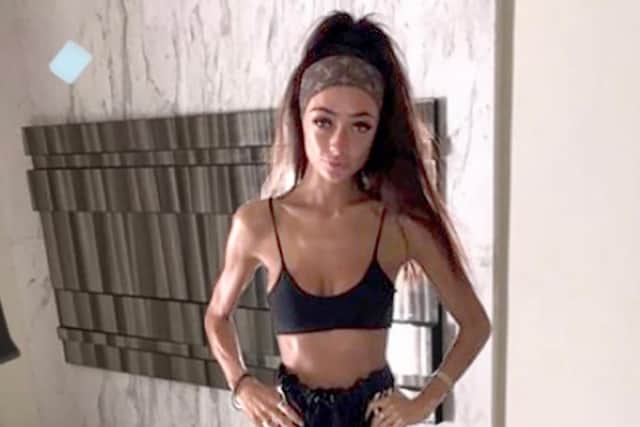 Lauren Hastings, in the midst of her eating disorder