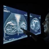 A NHS worker studies a breast cancer scan