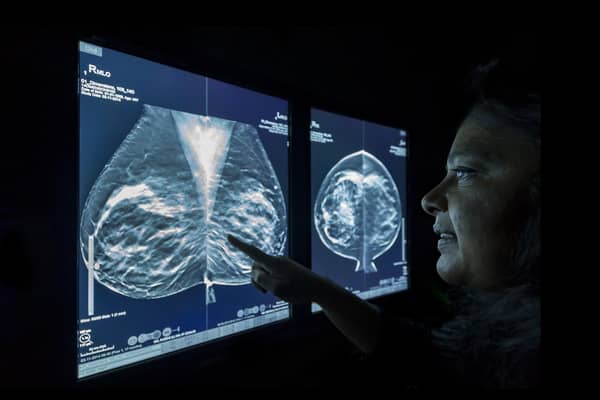 A NHS worker studies a breast cancer scan