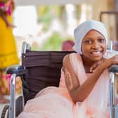 -Zainabu Haroub Said, who travelled 600km to Muhimbili, Tanzania for skin grafts and operations to treat severe burns. (Pic: Daud Lyon, KidsOR)