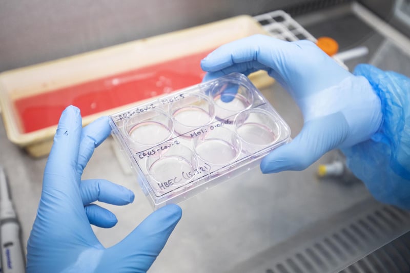 Dr Kieran Dee works in a Class II Microbiological Safety Cabinet with a sample of cultured cells that have been infected with SARS-CoV-2, the virus which causes COVID-19, to determine the genetic makeup of the virus,