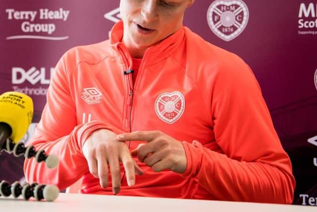 Gary Mackay-Steven explains his hand injury which required surgery and metal plates inserted.  (Photo by Ross Parker / SNS Group)