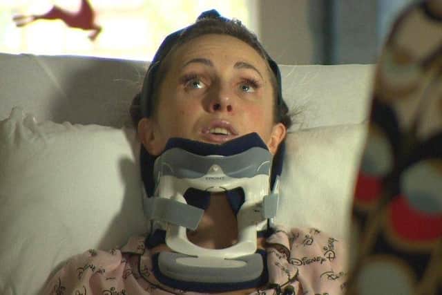 Edita Butkeviciute, now 31, said the impact has caused her “severe injury, permanent disfigurement and impairment”. (Credit: BBC)