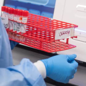 A lab technician Northwell Labs begins semi-automated testing for COVID-19.