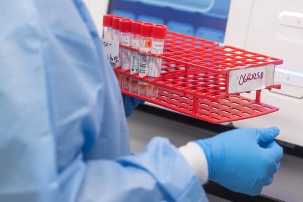 A lab technician Northwell Labs begins semi-automated testing for COVID-19.