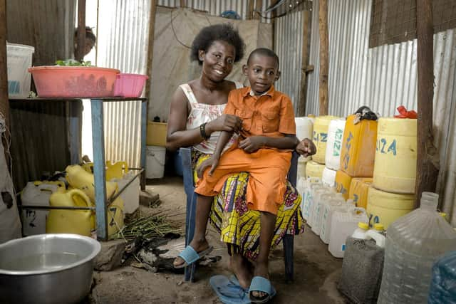 Little Jibril was born with a hernia and eventually treated in the operating room within Kakuma refugee camp in Kenya. (Pic:  KidsOR/Loduye Ghaisen)