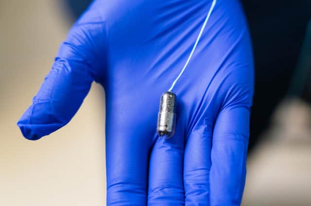 A "sponge on a string" device used to screen patients for cancer has been rolled out to all mainland health boards.