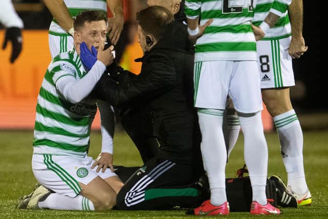 Callum McGregor suffered a facial injury in the Scottish Cup win over Alloa. (Photo by Craig Foy / SNS Group)