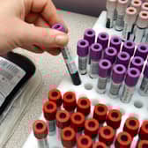 Scottish campaigners gave damning evidence to the infected blood inquiry