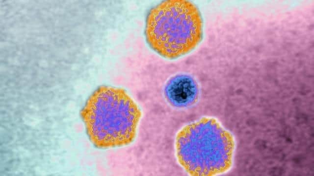 Adenovirus (highly contagious virus), responsible for: Colds, pharyngitis, bronchitis, pneumonia, gastroenteritis, conjunctivitis and keratitis.
(Photo by: Cavallini James/BSIP/Universal Images Group via Getty Images)