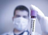 Early results from human trials suggest a vaccine could be available this year