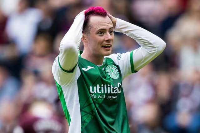 Hibs forward Harry McKirdy has had to rely on the backing of team-mates.