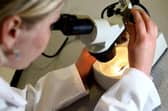 There have been fears of a delay in cancer diagnosis