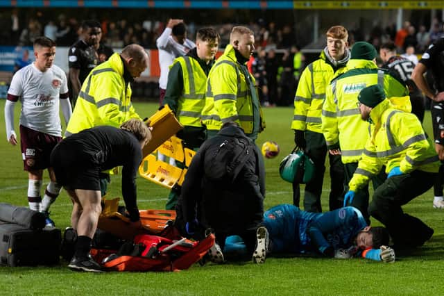 Hearts goalkeeper is out of the season after a double leg break sustained against Dundee United at Tannadice.