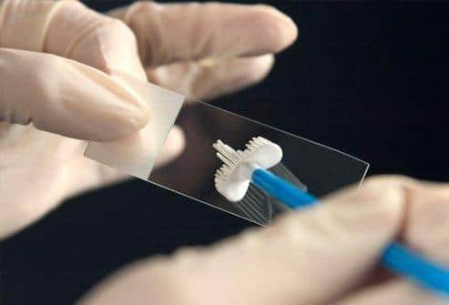 Cervical screening smear test uptake is below the Scottish Government’s target
