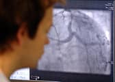 File picture of a surgical monitor showing heart arteries during angiogram procedure