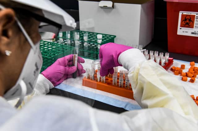 A lab technician sorts blood samples inside a lab for a Covid-19 study