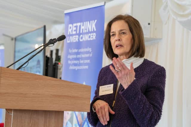 AMMF’s Helen Morement says cholangiocarcinoma is increasing among under-65s