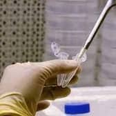 Tests are still being conducted to determine how the children contracted hepatitis.