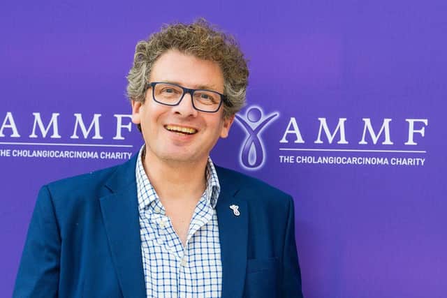 Benjamin Carey from Edinburgh is supporting the ‘Rethink Liver Cancer’ campaign