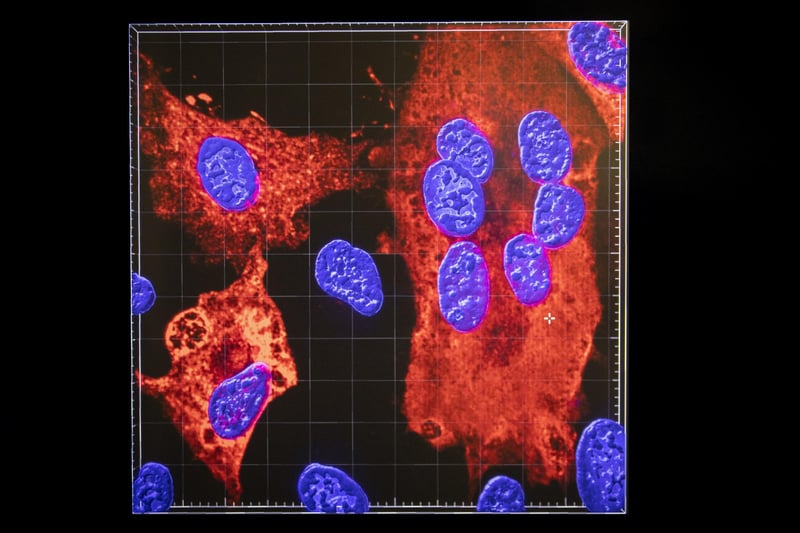 An image created with a confocal microscope shows cell nuclei (blue) being infected by SARS-CoV-2 (red areas), the virus which causes COVID-19,