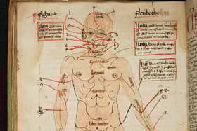 Diagram of the human body, showing the veins to be opened for blood-letting, in the 16th century. Curious medieval cures, including a treatment for gout that involved baking an owl then grinding it into a powder, are to be shared with the public online by Cambridge University Library.