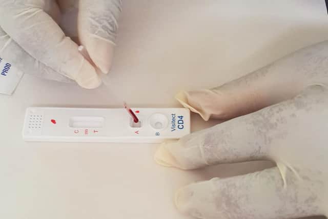 Omega Diagnostics' Visitect CD4 product enables people with HIV to test their immune systems.