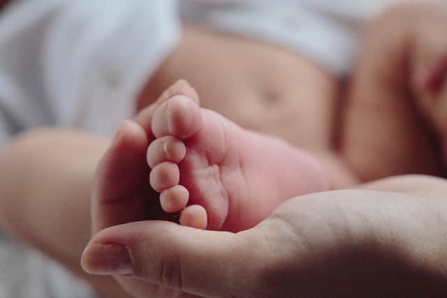 A report from the Royal College of Midwives (RCM) Scotland also shows that a majority of women using maternity services in Scotland are overweight or obese