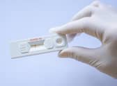 Covid-19 is just one of a number of potentially dangerous zoonotic diseases, which orginate in animals but can be passed on to humans. Picture: Getty Images