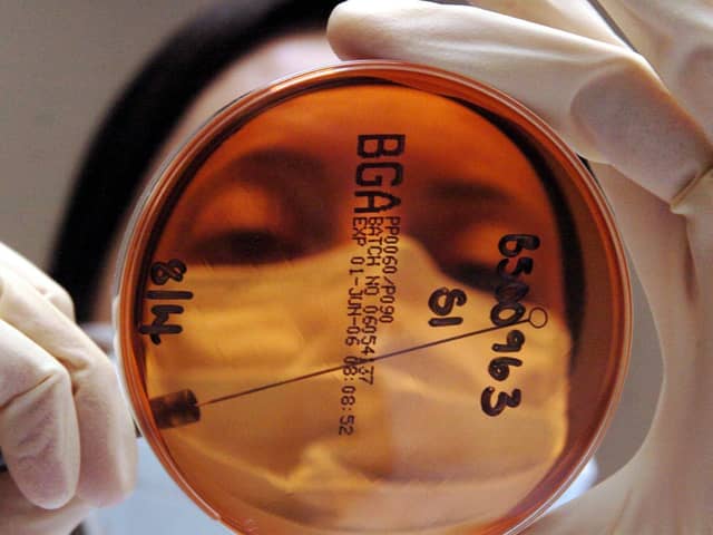 Cancer patients in Scotland will be among the first to trial a new treatment aimed at those with rare forms of the disease. Picture: Danny Lawson/PA Wire