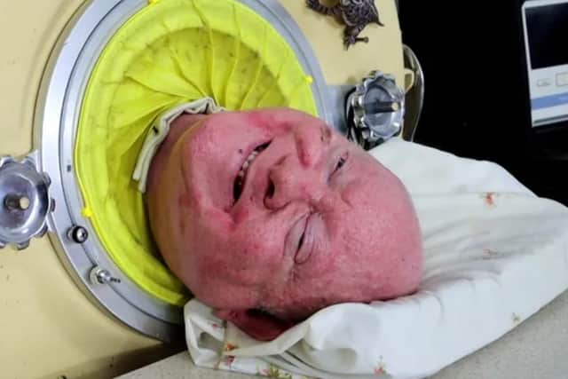 Paul Alexander, widely known as 'Polio Paul', has died at the age of 78 after spending more than 70 years in an iron lung. (Credit: GoFundMe)