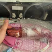 Hannah Stibbles who was born 25 weeks premature. Picture: Brandon Stibbles/SWNS