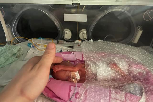 Hannah Stibbles who was born 25 weeks premature. Picture: Brandon Stibbles/SWNS