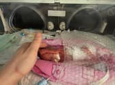 Hannah Stibbles who was born 25 weeks premature. Picture: Brandon Stibbles/SWNS