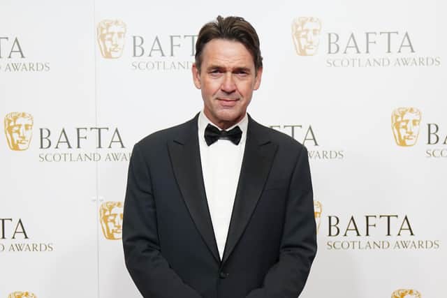Dougray Scott won a BAFTA Scotland best actor award for his portrayal of troubled detective Ray Lennox in Crime.