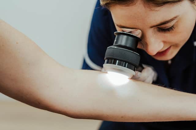 Skin cancer screening at The MOLE Clinic