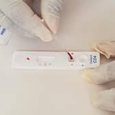 At the start of last month, Omega sold its CD4 testing business. CD4 is the part of the business that manufactures and supplies tests of Visitect CD4, which measures the amount of CD4 protein in human cells.