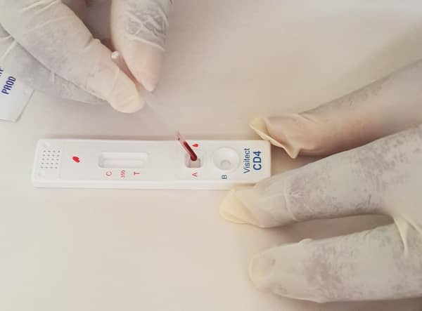 At the start of last month, Omega sold its CD4 testing business. CD4 is the part of the business that manufactures and supplies tests of Visitect CD4, which measures the amount of CD4 protein in human cells.