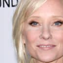 US actress Anne Heche who was reportedly taken to hospital in a critical condition following a collision that left her vehicle "engulfed in flames". The incident occurred on Friday morning in the Mar Vista area of Los Angeles, near to Ms Heche's home.