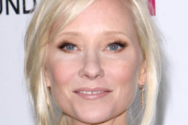 US actress Anne Heche who was reportedly taken to hospital in a critical condition following a collision that left her vehicle "engulfed in flames". The incident occurred on Friday morning in the Mar Vista area of Los Angeles, near to Ms Heche's home.