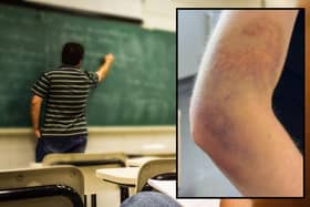 The EIS published a photo of a teacher's arms bruised after an attack (Pics: giovannacco/Pixabay & Fife EIS)